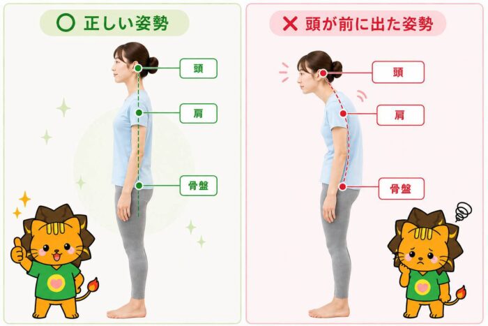 自律神経失調症の記事で姿勢との関係を説明する正しい姿勢と頭が前に出た姿勢の比較イラスト