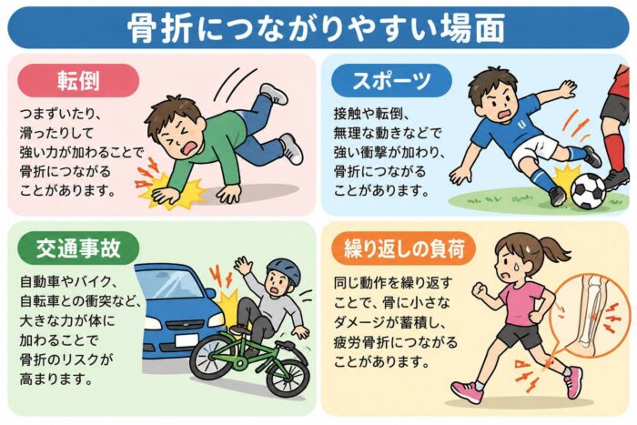 転倒やスポーツ、交通事故、繰り返しの負荷によって骨折につながる場面を示したイラスト