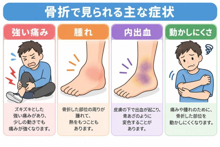 骨折で見られる強い痛みや腫れ、内出血、患部の動かしにくさを示したイラスト