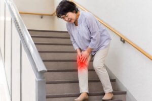 変形性膝関節症による膝の痛みで階段の昇り降りがつらい女性