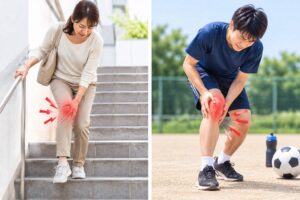 階段の上り下りやスポーツで膝の痛みを感じている人のイメージ