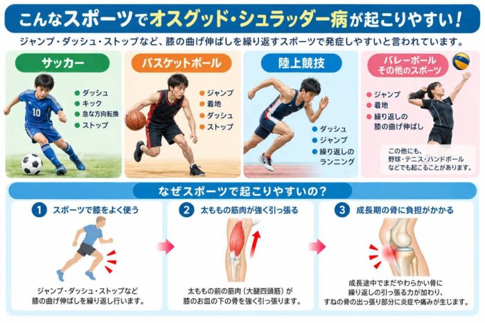 サッカー・バスケットボール・陸上競技など膝の曲げ伸ばしを繰り返すスポーツとオスグッド・シュラッター病の関係